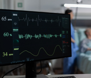 ECG Service